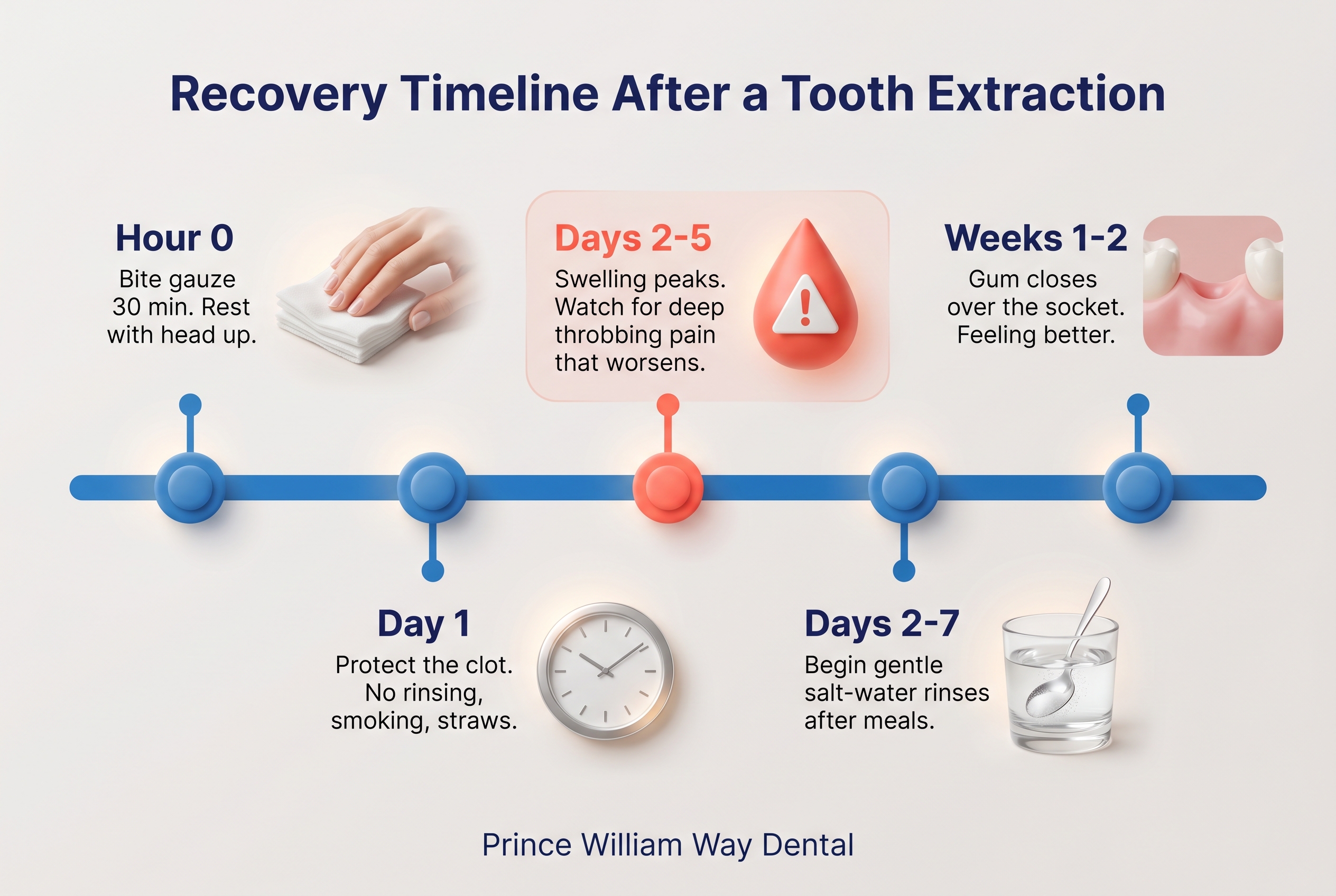 Horizontal timeline showing tooth extraction aftercare: hour zero bite on gauze, first 24 hours protect the clot, days two to seven gentle salt-water rinses, days two to five watch for dry socket pain (typically worst around day three), weeks one to two soft tissue closing over